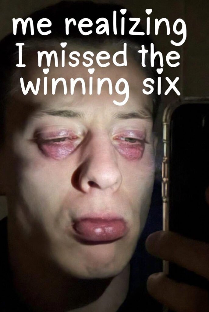 Blurry selfie lit by phone: bloodshot eyes, half-snoring mouth, messy overlay text “me realizing I missed the winning six”.